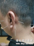 疫情期间想去针灸推拿班学实在拿手的真技术河池都安有安排吗？