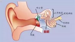 安庆助听器听力科普之耳硬化症！